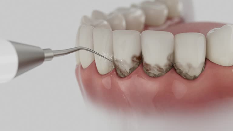 Reliable Dental Implants contractor in Coraopolis, PA by Smile Center Dentistry